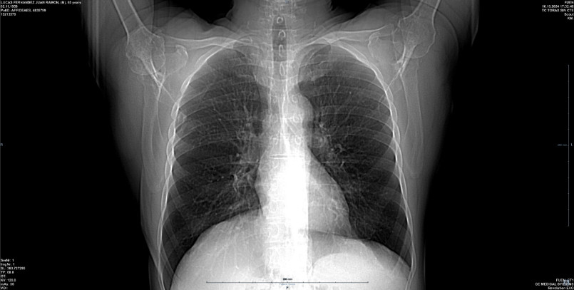 Imagen radiografía